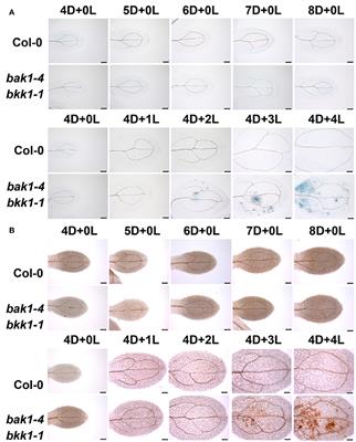 Both Light-Induced SA Accumulation and ETI Mediators Contribute to the Cell Death Regulated by BAK1 and BKK1